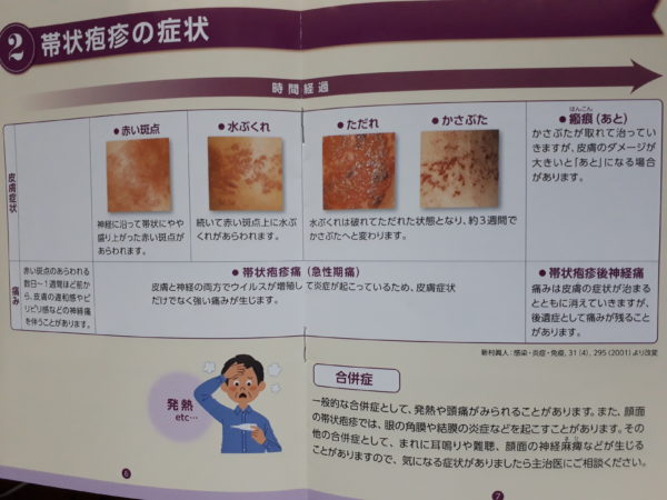 何か治りにくい?そして増える発疹=帯状疱疹!?年齢関係無くご注意を