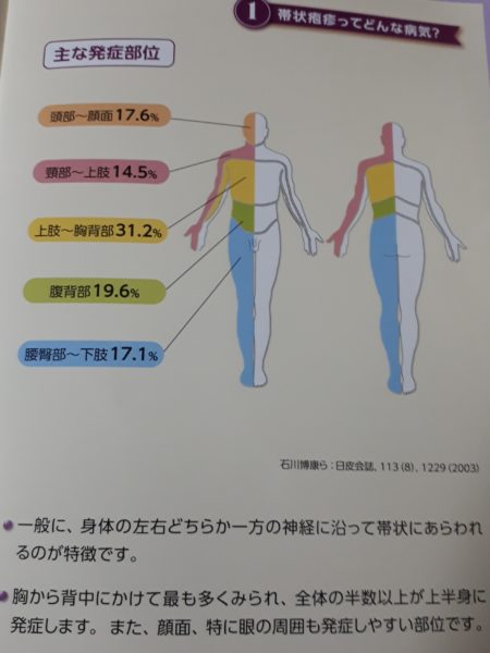 何か治りにくい?そして増える発疹=帯状疱疹!?年齢関係無くご注意を